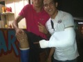 Los socio enyesado