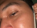 Me llegó la pubertad, se viene un barro y me duele horrible la nariz 🤬😢