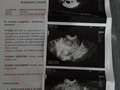 Que emoción voy a ser madre por segunda vez y después de 13 años, con mucho miedo y ansiedad pero super felíz.😍😍😍🤰