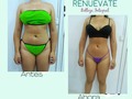 No te conformes con los resultados q ves en los demas y empieza a conseguir los tuyos. . . . . . #esteticarenuevate #esteticamente #esteticaprofesional #esteticafacial💆 #esteticapereira #esteticacorporal #esteticaavanzada #esteticaysalud #esteticaybelleza #reducciondemedidas #perdidadegrasa #perdidadetallas #perdidapeso #masajethai #masajereductor #masajesdescontracturantes #masajereductordeabdomen #masaje #masajethai #masajetailandés #pereiracolombia #pereiranas #pereirabellas #pereiracapitaldeleje #colombia