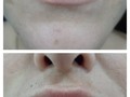 Volumen de labios. . . . . . #labioshermosos #labiosjovenes #labiosbellos #labiosmasgruesos #labiosparabesar #labiosqueexpresan #labiosperfectos #labios #labioshidratados #labiosrojos #esteticamente #esteticaprofesional #estéticarenuevate #esteticafacial💆 #esteticapereira #esteticista #elmejoresteticista #esteticayvida #pereira #risaralda #colombia #lamejorestetida #rejuvenecimientofacial
