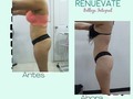 Cambios reales en personas reales. . . . . . #esteticarenuevate #esteticaprofesional #esteticapereira #lamejoresteticadepereira #resultadosreales #losmejoresresultados #mejorescuerpos #cuerposano #belleza #salud #cuerpofemenino #cuerpodeestetica #reducciondegrasa #reducciondecintura #reducciondemedidas #reduccionestomago #pereira #colombia #losmejorescuerpos #creandocuerpos #fabricadecinturas #lasmejorescurvas #esteticaysalud