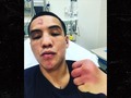 Boxing Champ Oscar Valdez Shows Aftermath Of Bloody Fight