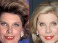 Christine Baranski -- Good Genes or Good Docs?!