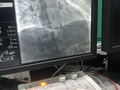 Primer día como interno de electrofisiologia