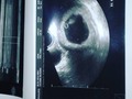 Voy a ser tíoooo!!! Aun no se que eres mi amor, pero desde que supe que venias ya te amaba!!! Te amo mi angelit@ hermos@!!! Asi o mas bendecido??