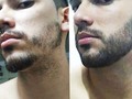 Las fotos de nuestros clientes comprueban la efectividad de nuestro COMBO BARBA EN TIEMPO RECORD