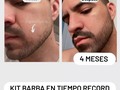 Resultados CLIENTE COMBO BARBA EN TIEMPO RECORD