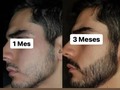 Resultados CLIENTE COMBO BARBA EN TIEMPO RECORD