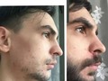 RESULTADOS BARBA EN TIEMPO RECORD