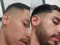 Desliza para veras cambios del KIT BARBA EN TIEMPO RECORD 💥