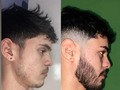 Resultados KIT BARBA EN TIEMPO RECORD
