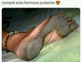 🤮