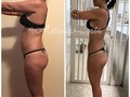 Celulitis... preguntas ufffff muchísimas, la más común, la celulitis se puede eliminar de manera total y rotunda, hay una sola respuesta y es si pero no 😂... ojo, pero por eso no debemos desmotivarnos, por que si se puede mejorar impresionantemente y disimular que casi se puede decir que no existe.  Por que digo que la celulitis no se puede pero si se puede eliminar?  Porque hay factores que influyen y esto significan que algunas personas están destinadas a tener celulitis sin importar cuánto se ejerciten, hay personas muy delgadas que la tienen, y hay hombres que también la padecen. Pero hay formas de reducir su apariencia.  La celulitis la podemos digamos que separar por tipos, para hacerlo más sencillo es como fases, una fase que es como acolchada que la denominan edematosa, a veces si te tocas la zona duele 😩, también está una que decimos, por que tengo celulitis si mi piel es dura? Pues así se llama celulitis dura 🙈, conseguimos la blanda que es la más común y viene acompañada con flacidez en la zona.  A veces, de pie o al sentarnos no vemos apariencia de celulitis, pero si pellizcamos la piel se hacen esos pequeños huecos que conocemos como piel de naranja, y es normal, es parte de ser mujer, parte de que nuestras hormonas funcionan y de que necesitamos grasa para que todo esto fluya con naturalidad.  Lo que no es normal es que permitamos que ese tejido adiposo cada día se acumule más y más por que es señal de que no le estamos dando a nuestro cuerpo lo que le corresponde para que trabaje de manera correcta.  Te lo juro, que con simples cambios en tus hábitos, comer mejor, hacer ejercicios, hidratarte de manera correcta, esa apariencia que tanto odiamos en la piel va a desaparecer al punto que creamos que no existe (aunque esté allí, muy abajo haciendo su real función). Así que no te preocupes, no es algo que desaparece de un día a otro, pero si es posible, con esfuerzo y buenos y saludables hábitos, vas a poder lucir con confianza y por supuesto, excelente Salud, unas lindas piernas, y por que no? Unas envidiables nalgotas 😂.