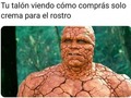 ¿Y las durezas de ahí abajo qué? - para mas chistes: Click aqui