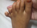 Six Toes of The Foot