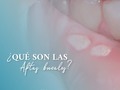AFTAS BUCALES🫢 Son pequeñas llagas redondas que aparecen en el interior de la boca y aparecen en cualquier parte de la mucosa oral. Se caracterizan por tener un borde rojo y un centro gris, suelen ser muy dolorosas.   🦠¿Por qué se producen? • Infecciones virales • Estrés • Alergias a los alimentos • Falta de vitaminas y minerales • Cambios hormonales o períodos menstruales • Sistema inmunológico deficiente   Sin embargo, a veces las causas son desconocidas   Por lo general desaparecen solas en un plazo de 7 a 14 días. Es importante evitar el consumo de alimentos picantes o muy condimentados  #aftasbucales #aftas #odontologia #odontologocaracas #osonrisa #venezuela #ortodoncia #diseñodesonrisa #blanqueamientodental #odontólogos #caracas #colinasdebellomonte #limpiezadental