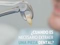 🦷| ¿Cuando es necesario extraer un diente?  Existen distintas razones por las que los odontólogos toman la decisión de extraer una pieza dental entre ellos:  • Una infección profunda en un diente (absceso)🦠 • Dientes aglomerados o dientes colocados incorrectamente 💢 • Enfermedad de las encías que afloja o daña los dientes🧏🏻 • Lesión de los dientes por un trauma 🦷 • Cordales (muelas de juicio) 🦷💢  Es importante que un profesional evalúe cada caso por separado para tomar la decisión correcta💙 . . #ondotrends #endodoncia #periodoncia #apiñamientodental #dientes #muelasdeljuicio #cordales #extraccion #extracciondental #saludental #colinasdebellomonte #odontologia #venezuela