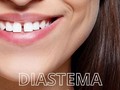 ¿Tienes un espacio entre tus dientes frontales?🫢  En odontologia a ese espacio le llamamos Diastema y puede ser causado por distintos factores tales como:  La genética 🧬 El tamaño de los dientes 🦷 La posición de la mandíbula 🫢  ¡Pero no te preocupes! Afortunadamente, en nuestro consultorio contamos con los tratamientos adecuados para corregirlo🤍 Entre ellos contamos con:  ▪️Ortodoncia (metálica, de cerámica e invisible) ▪️Tratamientos esté como las carillas dentales.   ¡No dejes que el diastema te impida sonreír con confianza!😄  #Diastema #SonrisaPerfecta #TratamientosDentales #esteticadental #caracas #venezuela