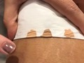 Sabias que las estrias pueden ser camufladas, con pigmentos especiales tonos piel, lucen imperceptibles a la vista, luce tu piel con la autoestima renovada. Mas informacion al whasapp +573014512474