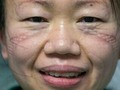 Estas son las caras de algunos héroes, enfermeras y médicos al rededor del mundo, pues son los que se encuentran en la primera línea de batalla luchando a contrareloj por largas jornadas contra el coronavirus, llevando en sus frentes, cachetes y narices, marcas como "medallas de oro"👩‍⚕️🏅💪 _ Nos muestran las heridas producto de varias horas de labor vistiendo los trajes de protección que deben usar para atender a los pacientes, para dejarnos un claro mensaje: #QuédateEnCasa 😷 _ Pasarán a la historia como algunas de las imágenes más emblemáticas del mundo en esta batalla. Fueron los especialistas quienes compartieron en sus redes sociales las fotografías que ilustran el agotamiento y las consecuencias de la dedicación en su labor de todos los días por combatir el #CODVI19 _ Nos unimos en solidaridad con todo el personal médico, alrededor del mundo, que día a día luchan contra esta #pandemia ¡No dudes compartir estas imágenes y dejarles tu mensaje de apoyo🙏! _ #PromoActualPZO #pzonline #PuertoOrdaz #pzocity #CiudadGuayana #EstadoBolívar #MunicipioCaroni #Coronavirus #CoronavirusEnVenezuela #Mundo #salud #Venezuela #medicina #YoMeQuedoEnCasa #cuarentena