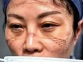 Estas son las caras de algunos héroes, enfermeras y médicos al rededor del mundo, pues son los que se encuentran en la primera línea de batalla luchando a contrareloj por largas jornadas contra el coronavirus, llevando en sus frentes, cachetes y narices, marcas como "medallas de oro"👩‍⚕️🏅💪 _ Nos muestran las heridas producto de varias horas de labor vistiendo los trajes de protección que deben usar para atender a los pacientes, para dejarnos un claro mensaje: #QuédateEnCasa 😷 _ Pasarán a la historia como algunas de las imágenes más emblemáticas del mundo en esta batalla. Fueron los especialistas quienes compartieron en sus redes sociales las fotografías que ilustran el agotamiento y las consecuencias de la dedicación en su labor de todos los días por combatir el #CODVI19 _ Nos unimos en solidaridad con todo el personal médico, alrededor del mundo, que día a día luchan contra esta #pandemia ¡No dudes compartir estas imágenes y dejarles tu mensaje de apoyo🙏! _ #PromoActualPZO #pzonline #PuertoOrdaz #pzocity #CiudadGuayana #EstadoBolívar #MunicipioCaroni #Coronavirus #CoronavirusEnVenezuela #Mundo #salud #Venezuela #medicina #YoMeQuedoEnCasa #cuarentena