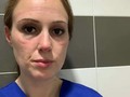 Estas son las caras de algunos héroes, enfermeras y médicos al rededor del mundo, pues son los que se encuentran en la primera línea de batalla luchando a contrareloj por largas jornadas contra el coronavirus, llevando en sus frentes, cachetes y narices, marcas como "medallas de oro"👩‍⚕️🏅💪 _ Nos muestran las heridas producto de varias horas de labor vistiendo los trajes de protección que deben usar para atender a los pacientes, para dejarnos un claro mensaje: #QuédateEnCasa 😷 _ Pasarán a la historia como algunas de las imágenes más emblemáticas del mundo en esta batalla. Fueron los especialistas quienes compartieron en sus redes sociales las fotografías que ilustran el agotamiento y las consecuencias de la dedicación en su labor de todos los días por combatir el #CODVI19 _ Nos unimos en solidaridad con todo el personal médico, alrededor del mundo, que día a día luchan contra esta #pandemia ¡No dudes compartir estas imágenes y dejarles tu mensaje de apoyo🙏! _ #PromoActualPZO #pzonline #PuertoOrdaz #pzocity #CiudadGuayana #EstadoBolívar #MunicipioCaroni #Coronavirus #CoronavirusEnVenezuela #Mundo #salud #Venezuela #medicina #YoMeQuedoEnCasa #cuarentena