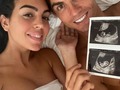 “Es con nuestra más profunda tristeza que tenemos que anunciar que nuestro bebé ha fallecido. Es el dolor más grande que cualquier padre puede sentir. Sólo el nacimiento de nuestra niña nos da la fuerza para vivir este momento con algo de esperanza y felicidad. Nos gustaría agradecer a los médicos y enfermeras por toda su experta atención y apoyo. Todos estamos devastados por esta pérdida y amablemente pedimos privacidad en este momento tan difícil. Nuestro bebé, eres nuestro ángel. Siempre te amaremos”🙏🏻.  Con estas palabras, hoy [18/4] Cristiano Ronaldo y Georgina Rodríguez han informado que uno de los mellizos que estaban esperando falleció. Como recordarán, la pareja indicó en octubre que tendrían dos hijos✨.  Fuerza para ellos en este duro momento. _ Vía: reporterorosa _ #CristianoRonaldo #GeorginaRodriguez #cristianoygeorgina #cr7 #viral #noticias #embarazo