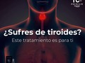 Tratamiento 💯 % natural rapido y efectivo,sin efecto rebote,pierde de 10 a 12 kilos de grasa localizada, elimina celulitis y reduce estrias 👌 #tc4premiumoficial las #lipogotas más efectivas del mercado.  Escribeme al whatsapp: +573193813036 y pregunta todo acerca de nuestro tratamiento 👍