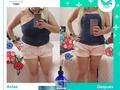 Pierde hasta 15 kilos de grasa localizada sin efecto rebote 👌🔝