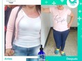 Pierde de 10 a 12 kilos de grasa localizada con un solo tratamiento 👌