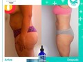 Tratamiento 💯 % natural rapido y efectivo,sin efecto rebote,pierde de 10 a 12 kilos de grasa localizada, elimina celulitis y reduce estrias 👌 #tc4premiumoficial las #lipogotas más efectivas del mercado.