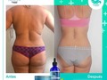 Tratamiento 💯 % natural rapido y efectivo,sin efecto rebote,pierde de 10 a 12 kilos de grasa localizada, elimina celulitis y reduce estrias 👌 #tc4premiumoficial las #lipogotas más efectivas del mercado.