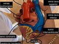 Modelos anatómicos prác de estudio, en este lbservamos el corazón y sus partes