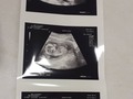 Con 14 semanas les presento mi hermos@ baby ... aún no sabemos el sexo.. lo bueno es que estoy en las mejores manos Dra @drakatita muy profesional y RECOMENDADISIMA.. que felicidad verl@ por primera vez.. a mi baby 🤰🏻🥰