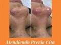 PUNTOS NEGROS... Generalmente ocasionados por piel o zonas de la piel muy grasa, aplicación de productos de higiene no indicados para el tipo de piel, exceso de maquillaje, stress, abuso en la ingesta de grasas saturadas, alergias y muchos otros factores.. Es por eso que siempre recomendamos realizar una higiene profunda profesional al menos una vez cada 2 meses, dependiendo del tipo de piel y las condiciones en las que se encuentre.. En Vellisimo estamos para servirte, con las medidas de BIOSEGURIDAD vigentes y previa cita.. Somos profesionales certificados a tu disposición! #higienefacial #estetica #depilaciones #laser #belleza #cuidadodelapiel